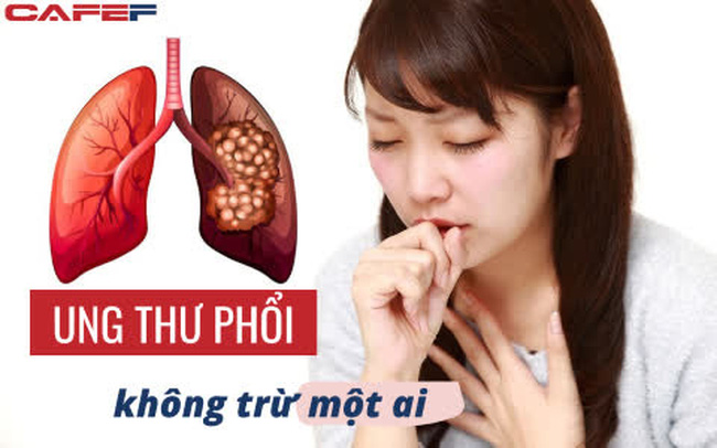 Cô gái 27 tuổi phát hiện ung thư phổi ác tính: Không hút thuốc, không uống rượu, cứ ngỡ mình sống lành mạnh nhưng cuối cùng phải cắt bỏ cả thùy phổi