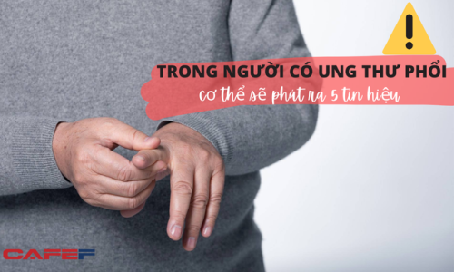 Khi bị ung thư phổi tấn công, cơ thể sẽ “réo lên” 5 tín hiệu: Thức giấc lúc 3 giờ sáng chớ coi thường, người đoản mệnh phần lớn là do lỗi chủ quan